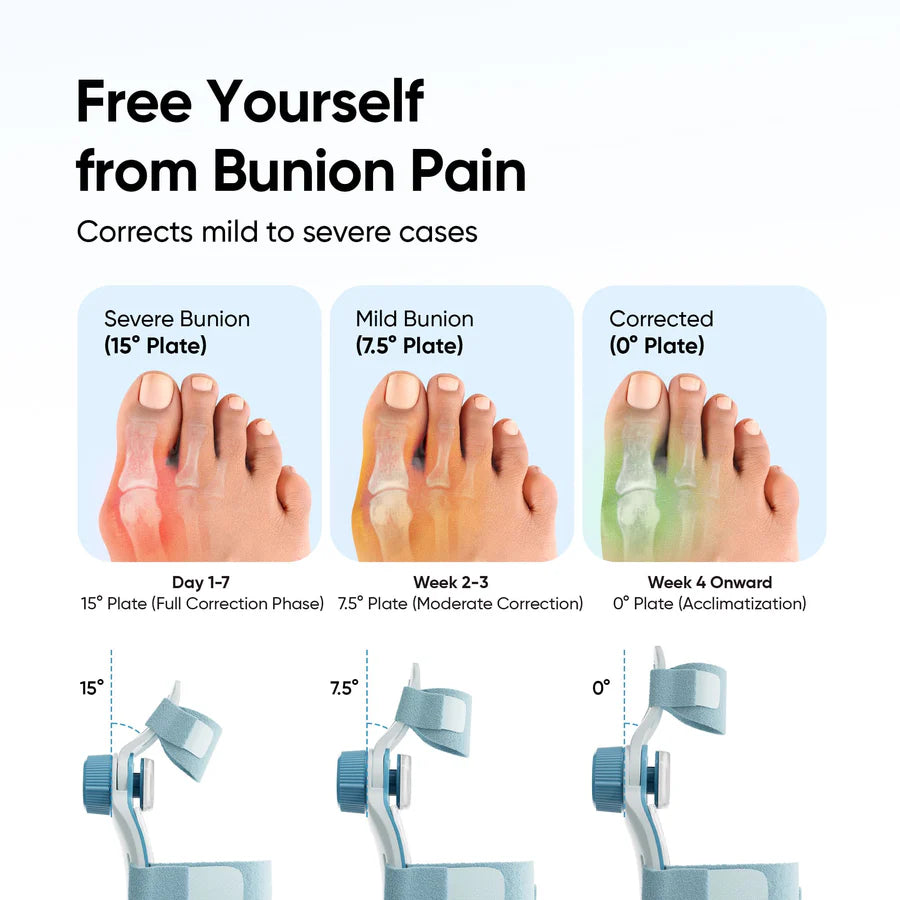 Zappnex Orthopedic Bunion Corrector